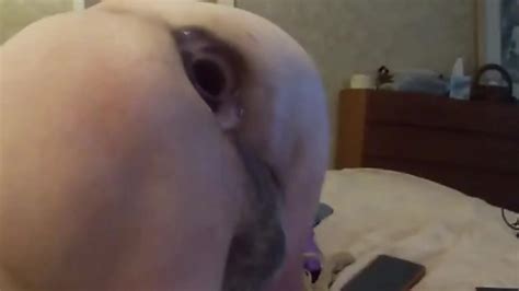 Crippled Amputee Uses Clear Buttplug To Open Ass ThisVid