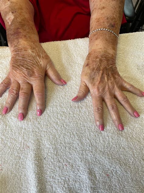 Madisonville Health and Rehabilitation - Home | Facebook