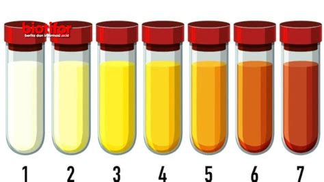 Warna Urine Yang Sehat Bisa Menjadi Pertanda Permasalahan Kesehatan