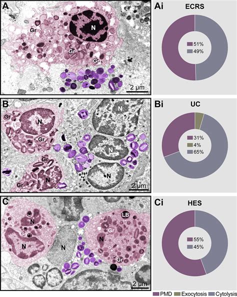 Eosinophil Electron Micrograph