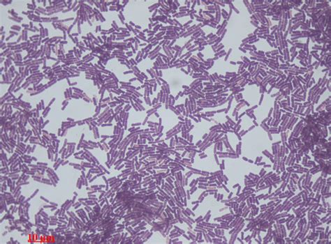 Gram-Positive Bacilli (Rods) - Microbiology learning: The "why"ology of ...