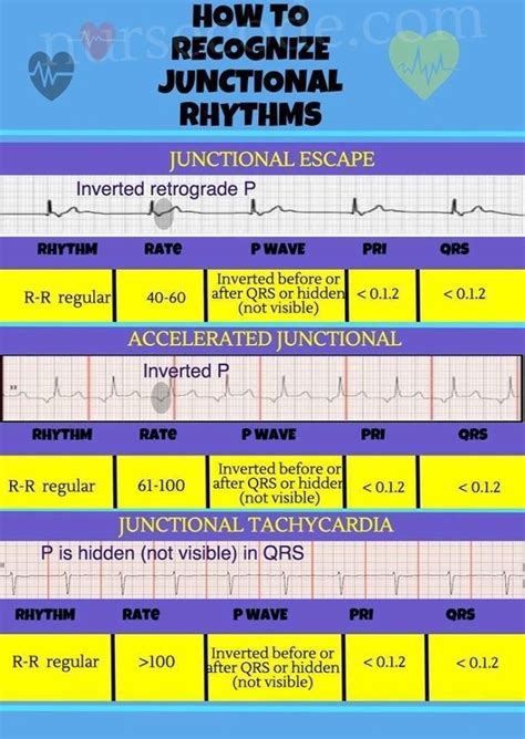 Student Paramedics — Junctional Rhythm Interpretation