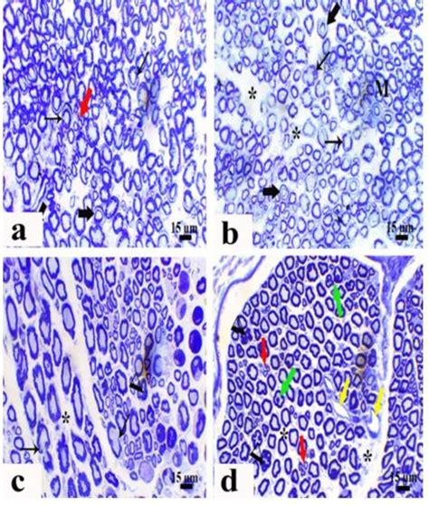 Photomicrographs Of Semi Thin Sections In Sciatic Nerves From A Control