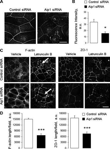 Actin Interacting Protein Controls Assembly And Permeability Of