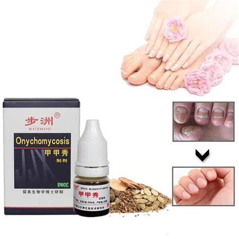 5 мл жидкость для восстановления натуральных ногтей эффективный гель ...