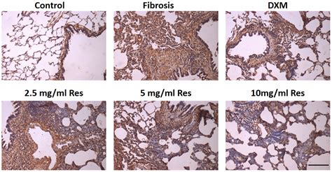 Resveratrol Alleviates Bleomycin Induced Pulmonary Fibrosis Via