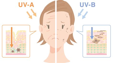 紫外線の量が1番多い時期はいつ？uva・uvb・uvcの違いを分かりやすく説明する！ Lovelog