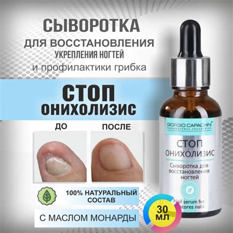 Сыворотка Стоп Онихолизис для лечения и восстановления ногтей с маслом ...