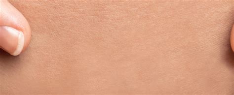 scars ciocca dermatology