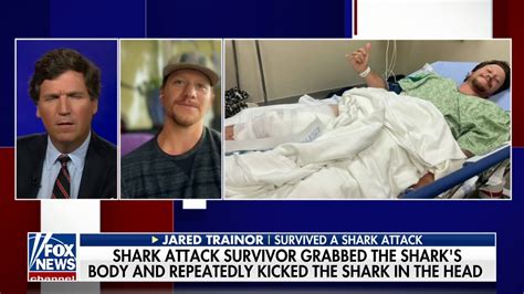 California man recounts Great White shark attack | Fox News Video