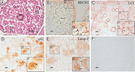 Immunoperoxidase Staining Of Atg Marker Proteins In The Ovary Of M