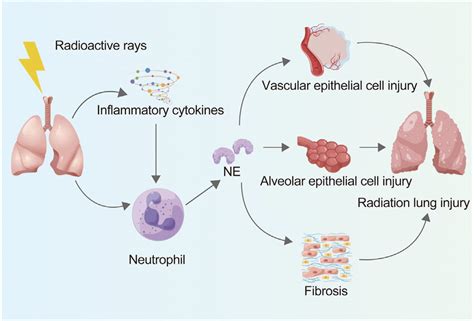 Ne Mediates Radiation Induced Lung Injuries Ne Neutrophil Elastase Download Scientific Diagram