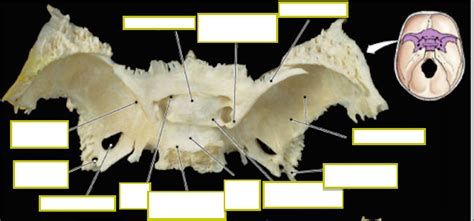 Superior View Of Sphenoid Bone Diagram Quizlet