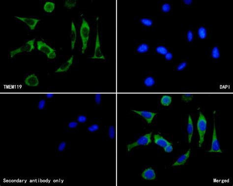 Tmem119 Polyclonal Antibody Pa5 119902