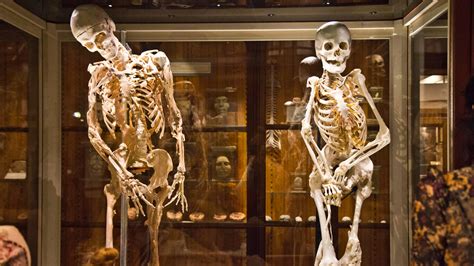 Mütter Museum takes down online exhibits, YouTube videos - WHYY