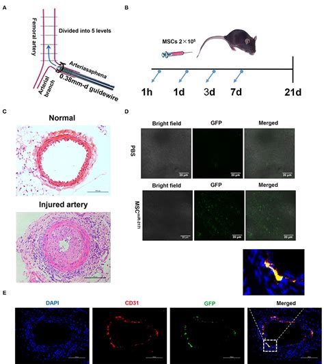 Frontiers Sustained Release Of Mir Inhibitor By Nanoparticles