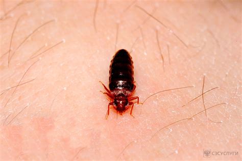 Укусы клопов: опасность и лечение