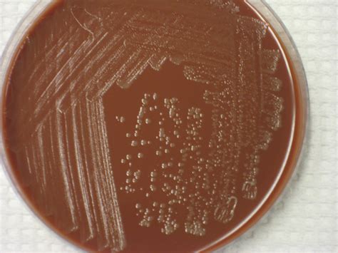 Haemophilus influenzae Virtual Lab Microbiology