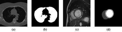 Examples of (a) a lung image (b) its lung mask (c) a cardiac image and ...