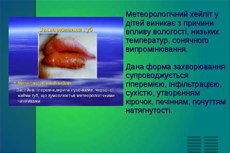 Хейліти. Самостійні хейліти. Симптоматичні хейліти, сучасний погляд