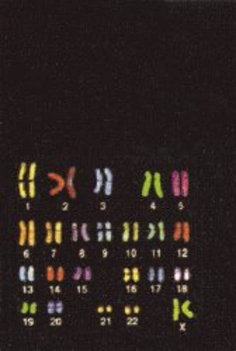 Los Genes Influyen En Ser Gay La Naci N