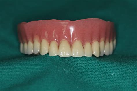 Full Dentures Mean Better Smiles Celina Tx