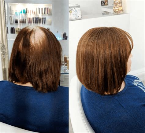 hair extensions  thinning hair  hair alchemist
