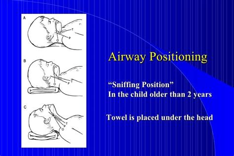 Pediatric Airway Management Winkler