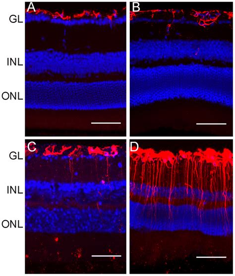 Retinal Gfap Expression In Wt And Ccl Cx Cr Gfp Gfp Mice