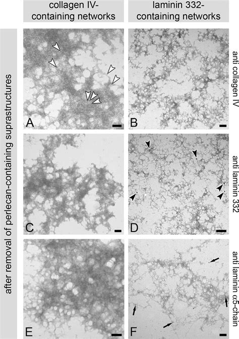 Discrete Collagen Iv And Laminin Containing Networks Of Human