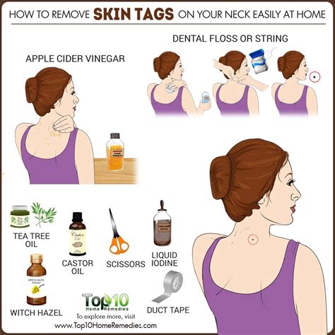 How to Remove Skin Tags on Your Neck Easily at Home | Top 10 Home Remedies