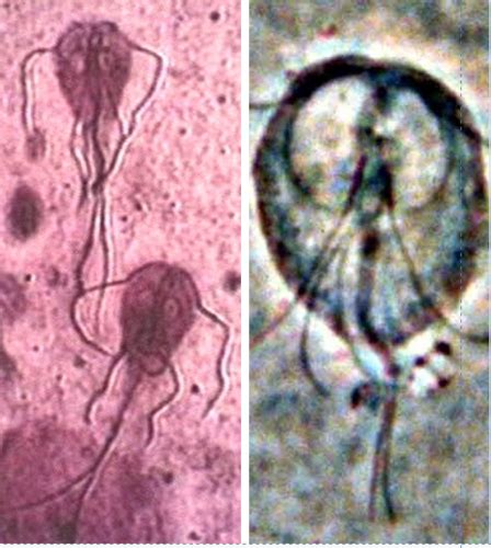 Parasitology Flagellates Flashcards Quizlet