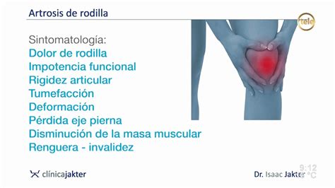 Artrosis De Rodilla Nuevos Tratamientos Parte Dr Isaac Jakter