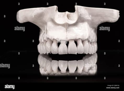 Upper Human Jaw With A Reflection On The Glass Anatomy Model Solated On