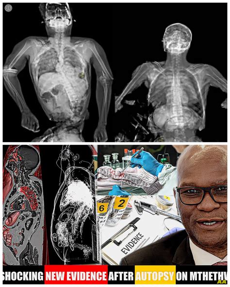 💀🔥Autopsy Shocker! What Doctors Found Inside Nathi Mthethwa’s Body