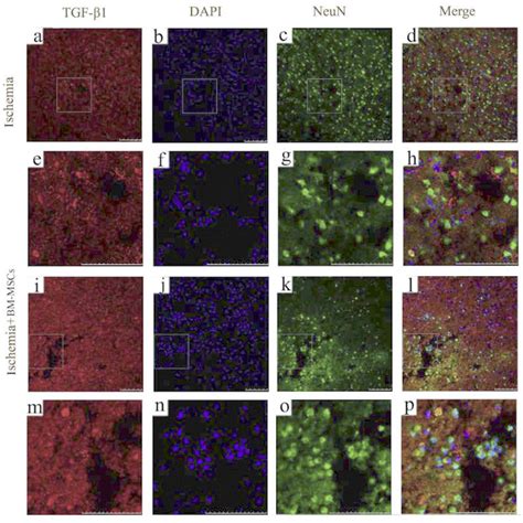 Tgf‐β1 And Neun Immunofluorescence Staining In The Infarcted Cortex Download Scientific Diagram