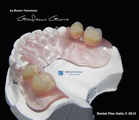 FlexiFast | Dental, Dental dentures, Dental design
