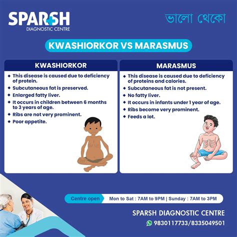 difference  kwashiorkor  marasmus  complete guide