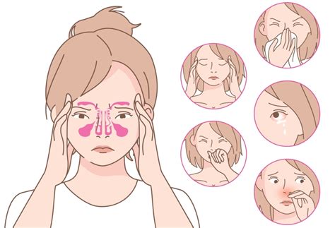 Аллергический ринит: всё о лечении и препаратах.