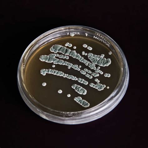 Penicillium RoquefortiiShop globules - Remedia Homeopathy