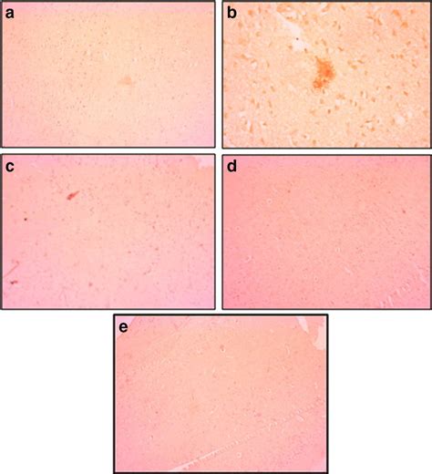 Congo Red Staining Of Cortex Region Of Brain Sections For Detection Of