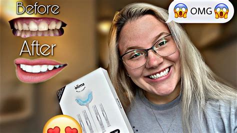 Trying Out The Smile Direct Club Teeth Whitening Kit YouTube