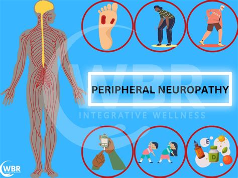 Peripheral Neuropathy