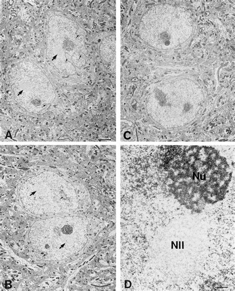 Ultrastructure Of The Nucleus Download Scientific Diagram