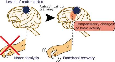 brain activity  occur    motor functions lost