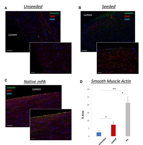 Figure 5 from Growth capacity of a Wharton’s Jelly derived mesenchymal ...