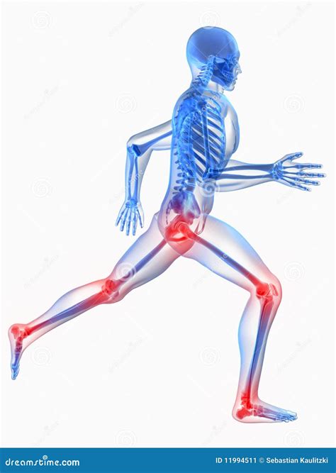Painful joints stock illustration. Illustration of action - 11994511