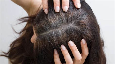 Premature Hair Greying Potential Reasons And Causes