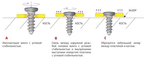 Мини винты 2,0 мм с угловой стабильностью. Медицина Для Жизни