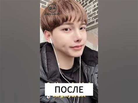 Пластика захватывает Корею все больше! - YouTube